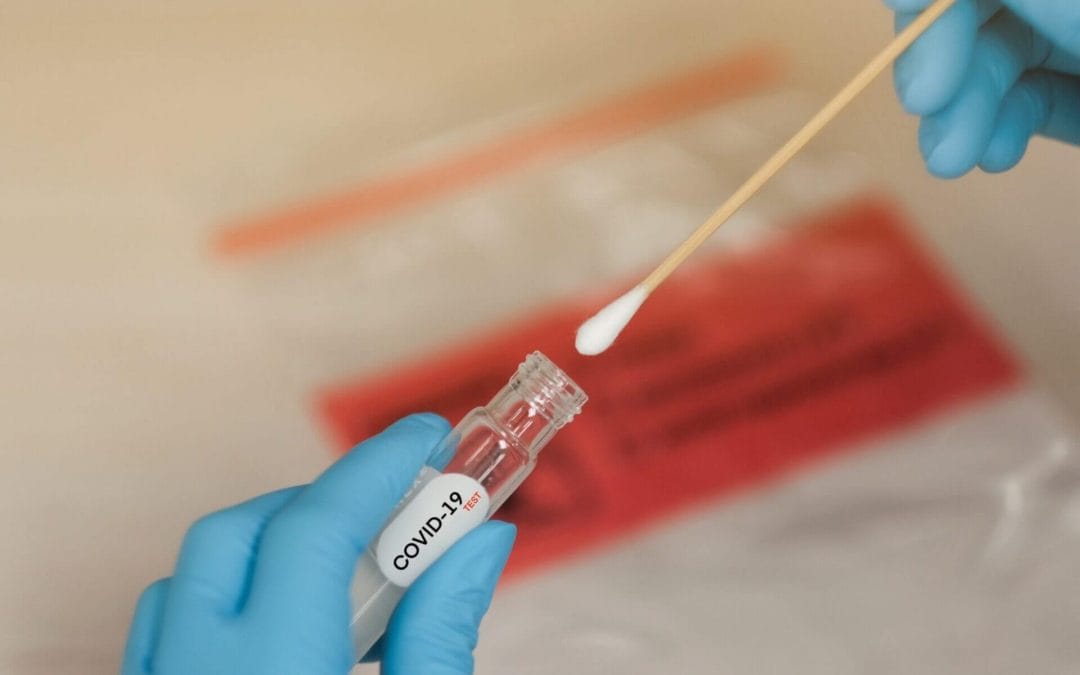 ¿Dónde realizarse una prueba COVID-19?